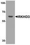 Mex-3 RNA Binding Family Member B antibody, A10435, Boster Biological Technology, Western Blot image 