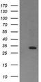 Retinoic Acid Receptor Responder 1 antibody, TA506083, Origene, Western Blot image 