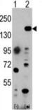 Histone-lysine N-methyltransferase EHMT1 antibody, abx025628, Abbexa, Western Blot image 