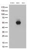 MHC Class I Polypeptide-Related Sequence B antibody, TA813497S, Origene, Western Blot image 