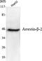 Arrestin Beta 2 antibody, M01443, Boster Biological Technology, Western Blot image 