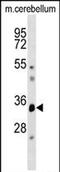 Dual specificity protein phosphatase 12 antibody, PA5-71975, Invitrogen Antibodies, Western Blot image 