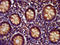 Enhancer Of MRNA Decapping 4 antibody, LS-C671864, Lifespan Biosciences, Immunohistochemistry paraffin image 
