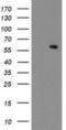 Makorin Ring Finger Protein 1 antibody, NBP2-01179, Novus Biologicals, Western Blot image 
