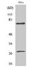 Lamin A/C antibody, STJ90056, St John