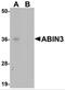 TNFAIP3 Interacting Protein 3 antibody, 5303, ProSci Inc, Western Blot image 