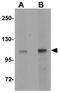 NLR Family Member X1 antibody, GTX84999, GeneTex, Western Blot image 