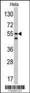Carbonic Anhydrase 9 antibody, 61-750, ProSci, Western Blot image 