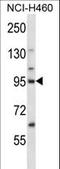Kinesin-like protein KIF2C antibody, LS-C165517, Lifespan Biosciences, Western Blot image 