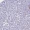 Parathyroid Hormone Like Hormone antibody, PA5-57493, Invitrogen Antibodies, Immunohistochemistry frozen image 