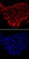 Forkhead Box D3 antibody, MAB5090, R&D Systems, Immunocytochemistry image 