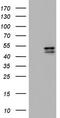 Casein Kinase 1 Epsilon antibody, TA803780, Origene, Western Blot image 