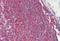 Ribosomal Protein L8 antibody, NB100-68143, Novus Biologicals, Immunohistochemistry paraffin image 