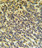 Phospholipase A2 Group VI antibody, 64-196, ProSci, Immunohistochemistry paraffin image 