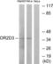 Olfactory Receptor Family 2 Subfamily D Member 3 antibody, LS-C120841, Lifespan Biosciences, Western Blot image 