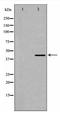 Dematin Actin Binding Protein antibody, TA348010, Origene, Western Blot image 