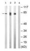 Protein Kinase C Epsilon antibody, ab63387, Abcam, Western Blot image 