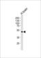 Potassium Voltage-Gated Channel Subfamily J Member 12 antibody, 59-354, ProSci, Western Blot image 