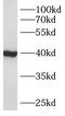 Acyl-CoA Wax Alcohol Acyltransferase 2 antibody, FNab00751, FineTest, Western Blot image 