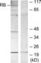 RB Transcriptional Corepressor 1 antibody, LS-B7581, Lifespan Biosciences, Western Blot image 