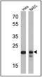 Proteasome Subunit Beta 6 antibody, GTX23331, GeneTex, Western Blot image 