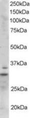 Lck-interacting transmembrane adapter 1 antibody, TA305824, Origene, Western Blot image 