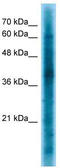 CRK Like Proto-Oncogene, Adaptor Protein antibody, TA329153, Origene, Western Blot image 