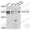 M-PST antibody, A7932, ABclonal Technology, Western Blot image 
