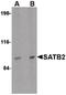DNA-binding protein SATB2 antibody, PA5-20532, Invitrogen Antibodies, Western Blot image 