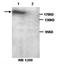 Poly(ADP-Ribose) Polymerase Family Member 14 antibody, orb76944, Biorbyt, Western Blot image 