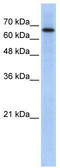 Rho GTPase Activating Protein 28 antibody, TA336131, Origene, Western Blot image 