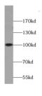 A-Kinase Anchoring Protein 3 antibody, FNab00255, FineTest, Western Blot image 