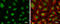 ATR Serine/Threonine Kinase antibody, GTX133852, GeneTex, Immunofluorescence image 