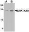 Spermatogenesis Associated 19 antibody, LS-B9605, Lifespan Biosciences, Western Blot image 