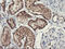 Decaprenyl Diphosphate Synthase Subunit 2 antibody, M06930, Boster Biological Technology, Immunohistochemistry paraffin image 
