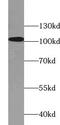 5'-3' Exoribonuclease 2 antibody, FNab09557, FineTest, Western Blot image 