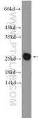BMERB Domain Containing 1 antibody, 26037-1-AP, Proteintech Group, Western Blot image 