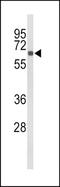 Cytochrome P450 Family 27 Subfamily B Member 1 antibody, TA325091, Origene, Western Blot image 