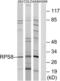 Ribosomal Protein S8 antibody, LS-C119649, Lifespan Biosciences, Western Blot image 
