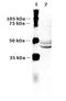 Vasopressin V2 receptor antibody, A01660, Boster Biological Technology, Western Blot image 