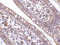 Cell Death Inducing DFFA Like Effector B antibody, 2321, ProSci Inc, Immunohistochemistry paraffin image 