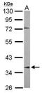 Protein Phosphatase 2 Phosphatase Activator antibody, GTX105724, GeneTex, Western Blot image 