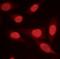 Protein Phosphatase 2 Scaffold Subunit Aalpha antibody, PA5-17516, Invitrogen Antibodies, Immunofluorescence image 