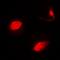SUFU Negative Regulator Of Hedgehog Signaling antibody, orb341171, Biorbyt, Immunocytochemistry image 