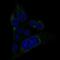 MET Transcriptional Regulator MACC1 antibody, NBP2-52955, Novus Biologicals, Immunocytochemistry image 