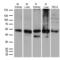 Aldehyde Dehydrogenase 9 Family Member A1 antibody, LS-C796588, Lifespan Biosciences, Western Blot image 