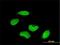 Protein CBFA2T1 antibody, H00000862-M01, Novus Biologicals, Immunocytochemistry image 