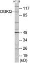 Diacylglycerol Kinase Theta antibody, EKC1748, Boster Biological Technology, Western Blot image 