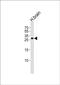 Regulating Synaptic Membrane Exocytosis 4 antibody, PA5-49568, Invitrogen Antibodies, Western Blot image 