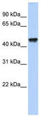 Queuine TRNA-Ribosyltransferase Accessory Subunit 2 antibody, TA346825, Origene, Western Blot image 